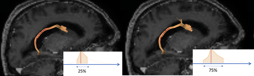 White Matter Uncertainty screenshot